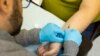 OMS declara que la viruela del mono ya no es una emergencia sanitaria mundial