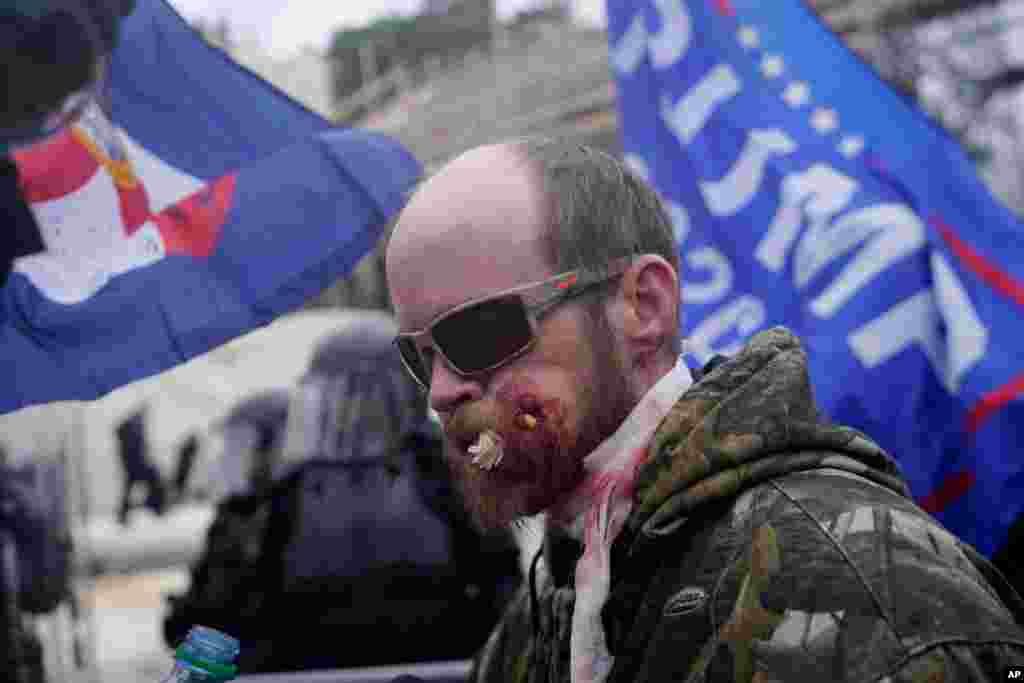 Un manifestante aparece herido durante un enfrentamiento con la polic&#237;a durante un mitin en el Capitolio en Washington.
