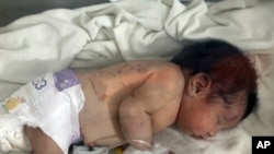 Una bebé que nació bajo los escombros causados por el terremoto que sacudió Siria y Turquía recibe tratamiento dentro de una incubadora en un hospital infantil en la ciudad de Afrin, provincia de Alepo, Siria, el martes 7 de febrero de 2023. Residentes en el noroeste Pueblo sirio descubrieron a la bebé llorando. Su madre dio a luz mientras estaba enterrada bajo los escombros de un edificio de apartamentos de cinco pisos arrasado por el devastador terremoto, dijeron familiares y un médico. (Foto AP/Ghaith Alsayed)