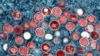 ARCHIVO - Una micrografía electrónica de transmisión coloreada de partículas de viruela símica (rojas), halladas dentro de una célula infectada (azul) cultivada, captada y coloreada por investigadores del Instituto Nacional de Enfermedades Alérgicas e Infecciosas de EEUU. 