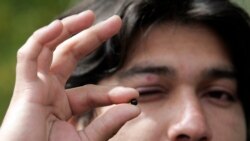 Un joven muestra uno de los balines usados por la policía chilena para reprimir a los protestantes y con los que decenas han perdido parcial o completamente la vista.
