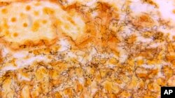 ARCHIVO - En esta fotografía de microscopio de 1966 distribuida por los Centros para el Control y la Prevención de Enfermedades de EEUU se ve una muestra de tejido con la presencia de espiroquetas Treponema pallidum, la bacteria responsable de la sífilis. 
