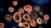 This 2020 electron microscope image provided by the National Institute of Allergy and Infectious Diseases - Rocky Mountain Laboratories shows SARS-CoV-2 virus particles which cause COVID-19, isolated from a patient in the U.S., emerging from the surface o