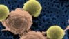 Terapia asombrosa contra leucemia
