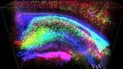 Flies Help Understand How Human Brains Work