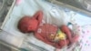 World Prematurity Day Aims to Lower Premature Births