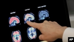 ARCHIVO - Un médico revisa una tomografía del cerebro en el Instituto Banner sobre Alzheimer en Phoenix, el 14 de agosto de 2018.