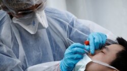 La prueba generalizada es por medio de un hisopo que se introduce por la nariz para obtener muestras de células en las mucosas.