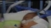 Dünyada hər il bir milyondan artıq vaxtından əvvəl doğulan körpə ölür 