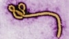 Ebola: Novi virus, nova epidemija i zašto trebamo znati više o ovoj bolesti