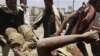 Mortal represión en Yemen