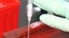 Tuberculosis vaccine research at Vaccine Discovery at Aeras