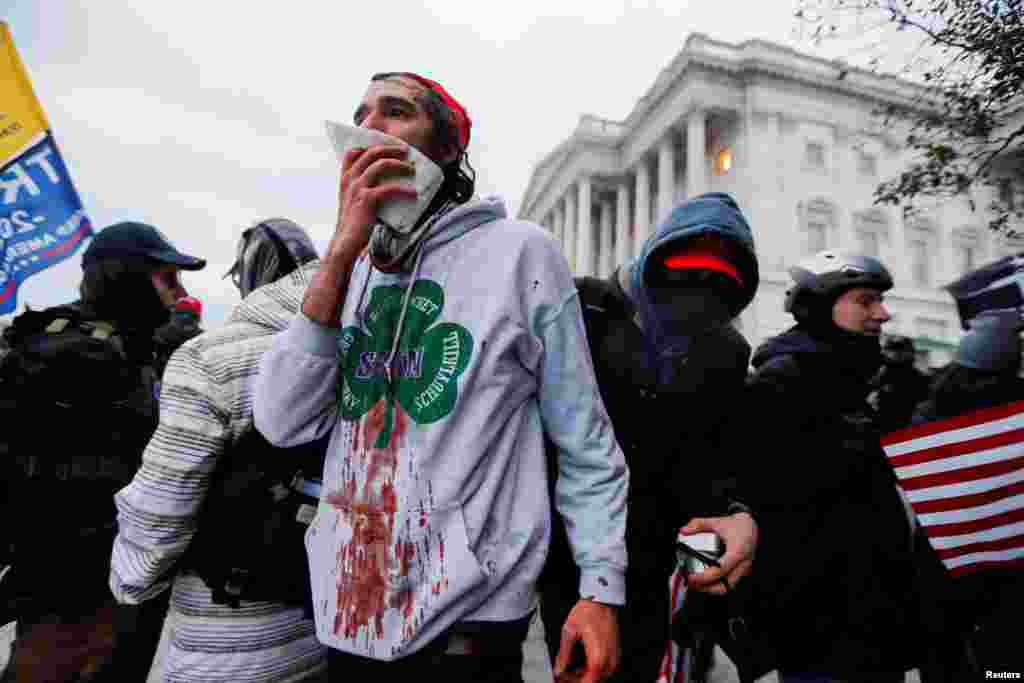 Un partidario herido del presidente Trump, reacciona durante una protesta contra la certificaci&#243;n de las elecciones presidenciales de Estados Unidos de 2020.