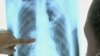OMS busca mejorar la salud