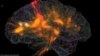 An image of activity in a human brain